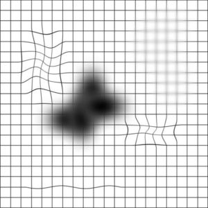 alteracoes-tela-de-amsler-2